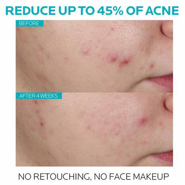 CeraVE EFFACLAR SALICYLIC ACID ACNE TREATMENT SERUM - Hopshop