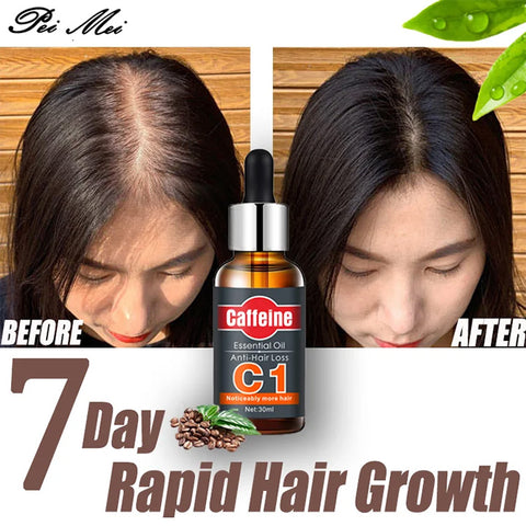 Caffenine anti-hair loss essential oil hair care 30ml - Hopshop